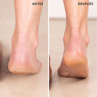 Vegan Hero All-Purpose Balm  40ml-214296 Vegan Hero All-Purpose Balm  40ml-214296 1